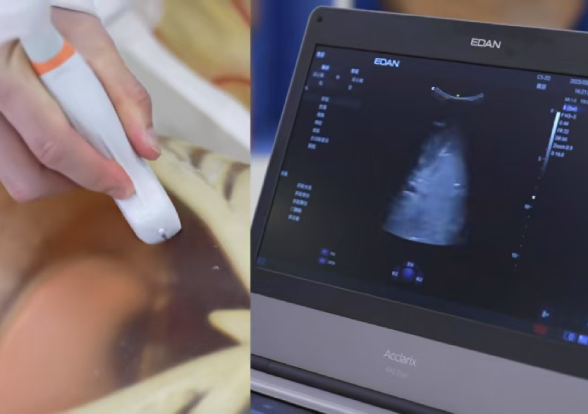 综合超声检查平台2.0